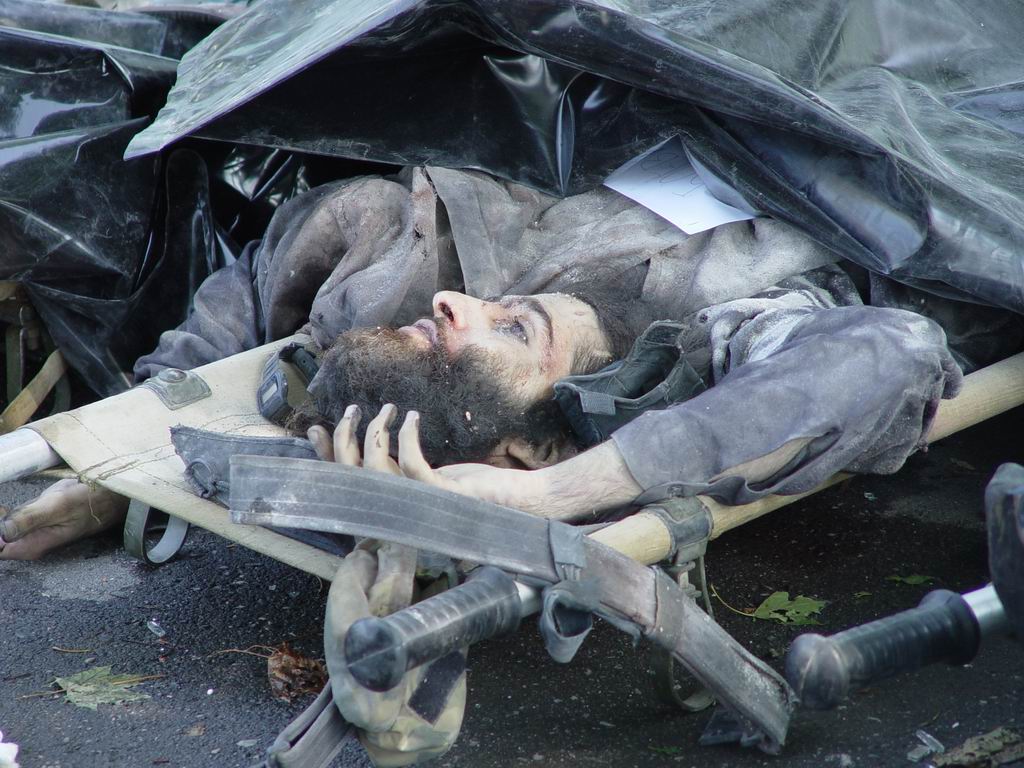 Beslan. Severed head