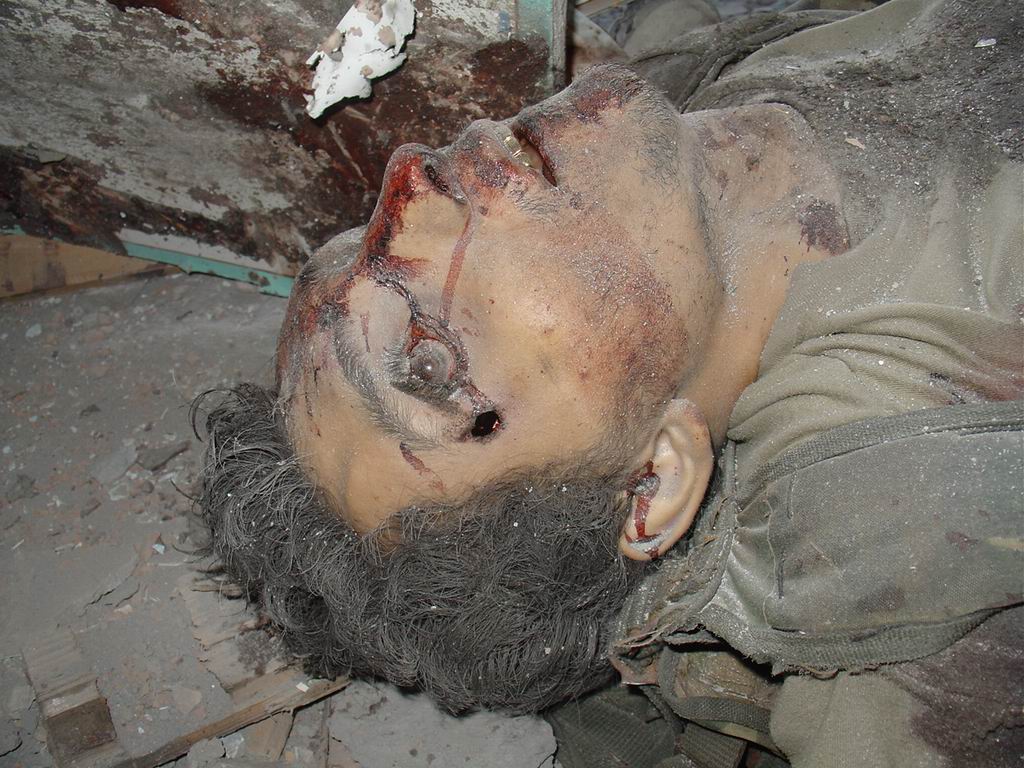 Beslan. The corpse of a terrorist with a bullet hole in his head