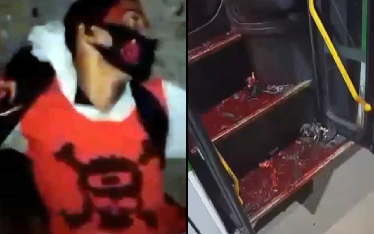 Grenade in hand exploded. Video. Brazil. DEADHOUSE