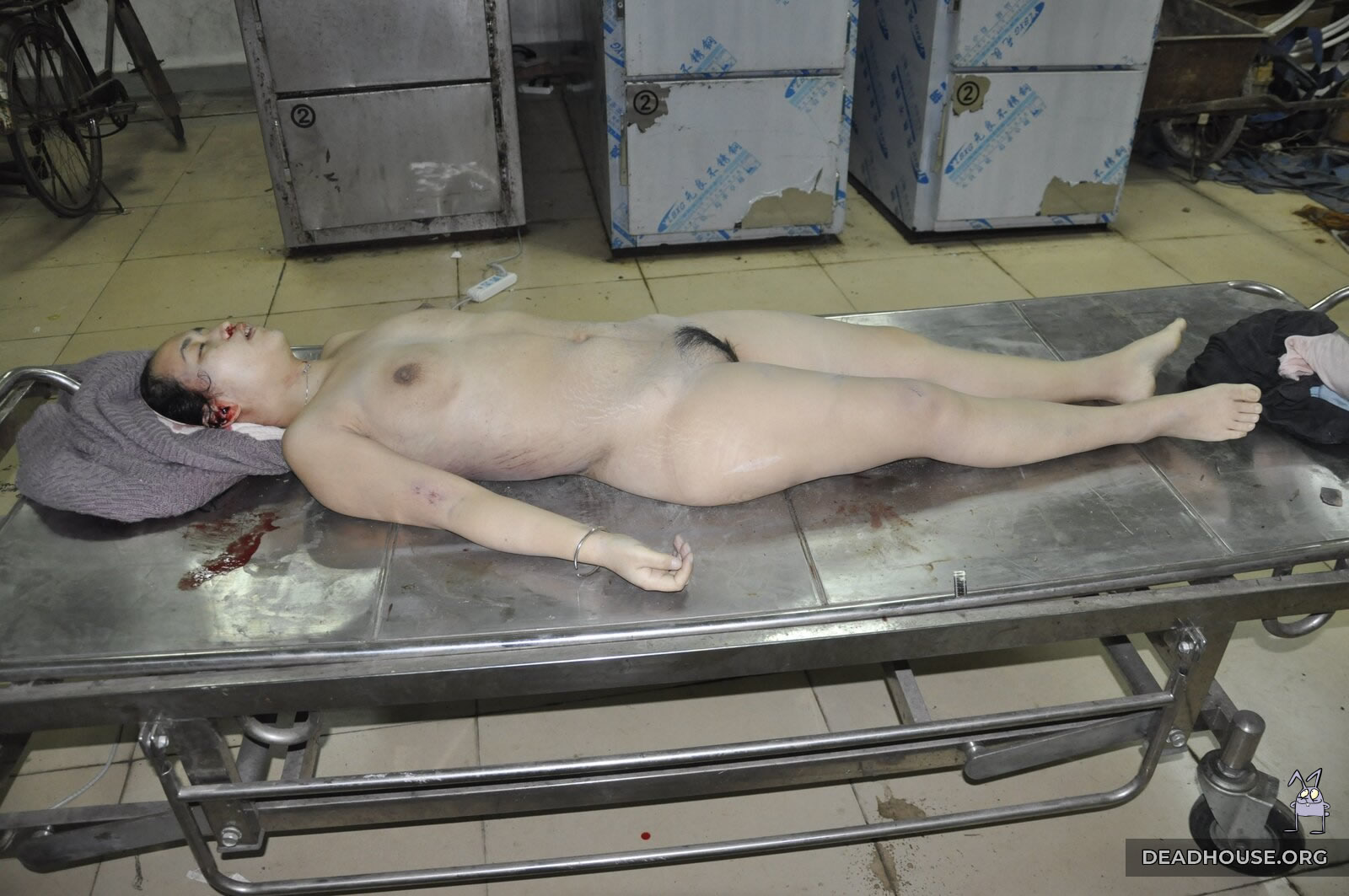 Naked girl in the morgue.