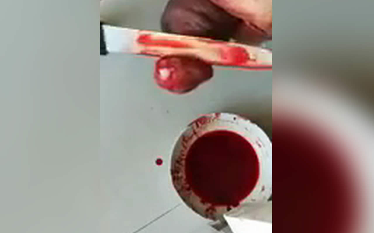 The man cuts the head of the penis. Bloody deviation