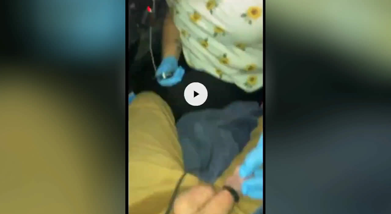 Женщина отрезает мужчине головку полового члена