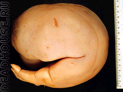 Мутация эмбриона. Безголовый Эркади