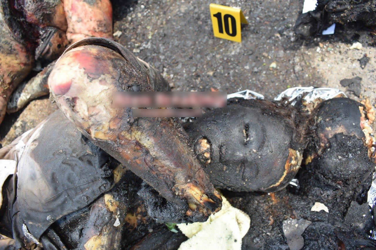 Killed as a result of shelling. Vinnitsa. Ukraine