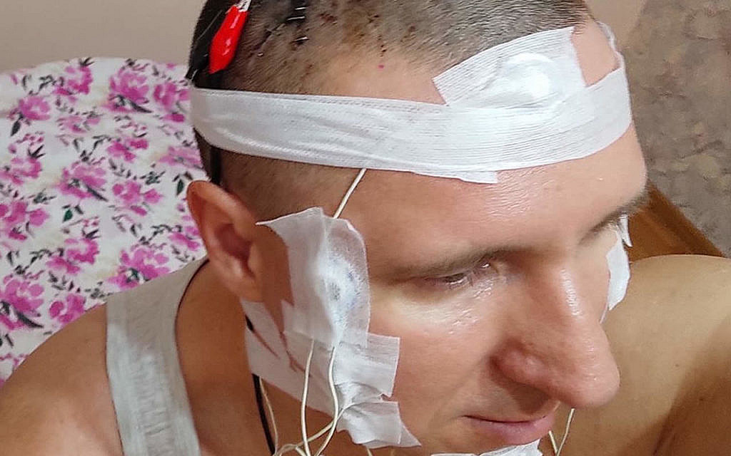A man implanted an electrode in his brain at home