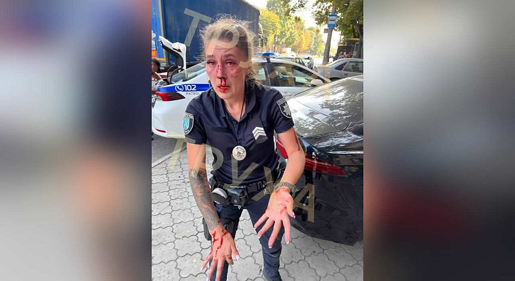 Женщина-полицейский получила травмы лица и головы.