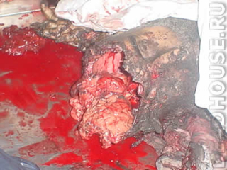 Труп. Жертва израильских бомбежек