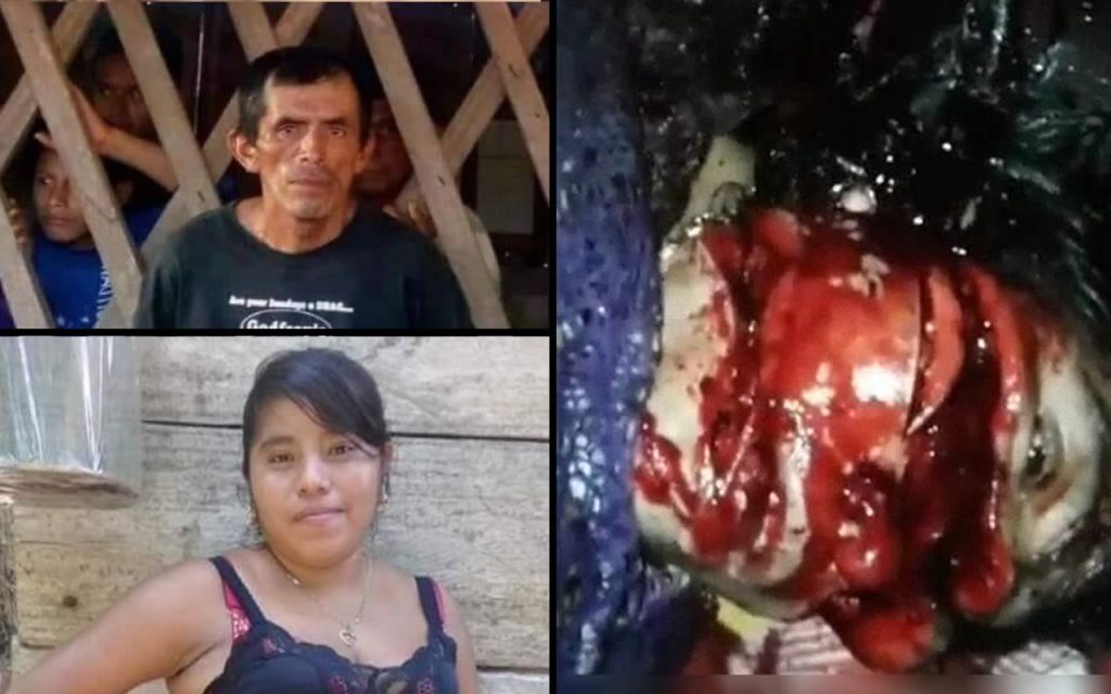 Man hacked his wife with a machete
