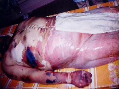 Этот человек умер от пыток в тюрьме Узбекистана
