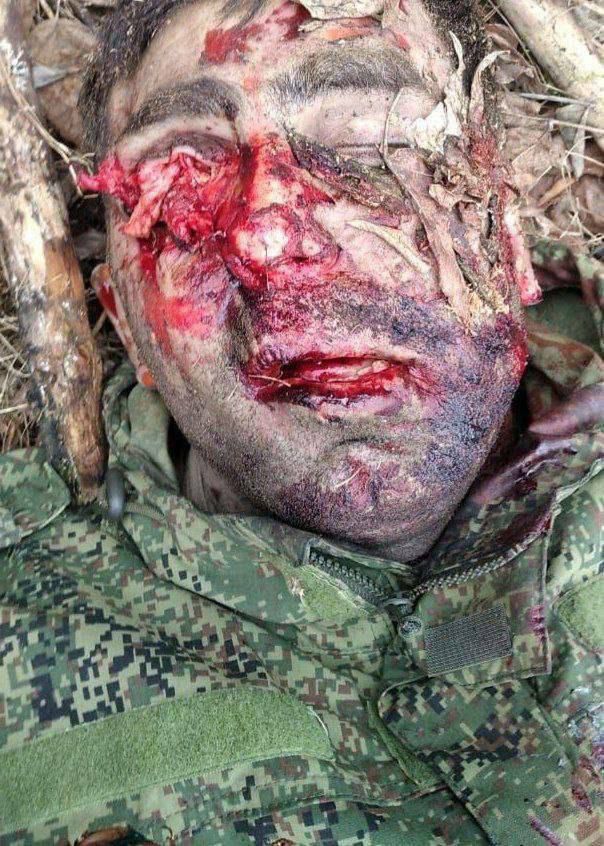 Обезображенное лицо трупа российского военнослужащего